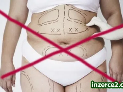 Liposukce - To snad NE!