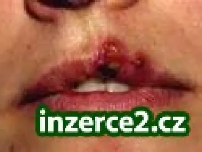 Máte kožní či alergické problémy?