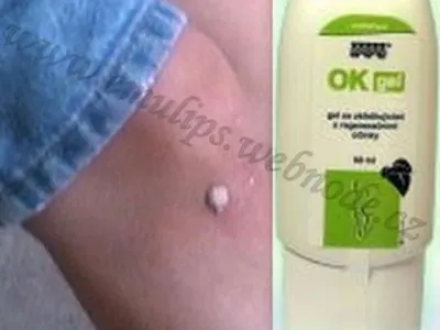 BRADAVICE MÉHO SYNA JSOU JIŽ MINULOSTÍ - OK GEL