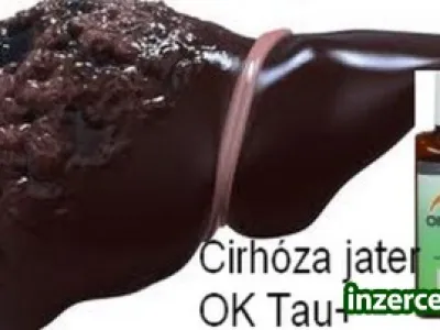 Pomůže při CIRHOZE JATER
