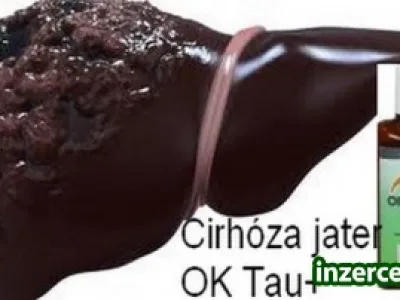 Pomůže při CIRHOZE JATER