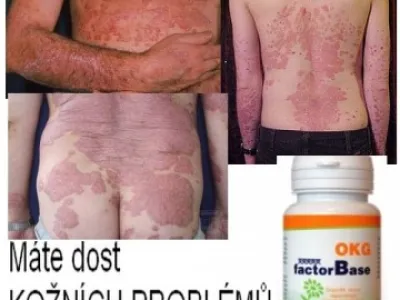 Trápí Vás KOŽNÍ PROBLÉMY?