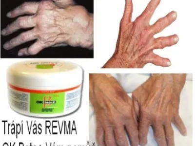 Máte REVMA?